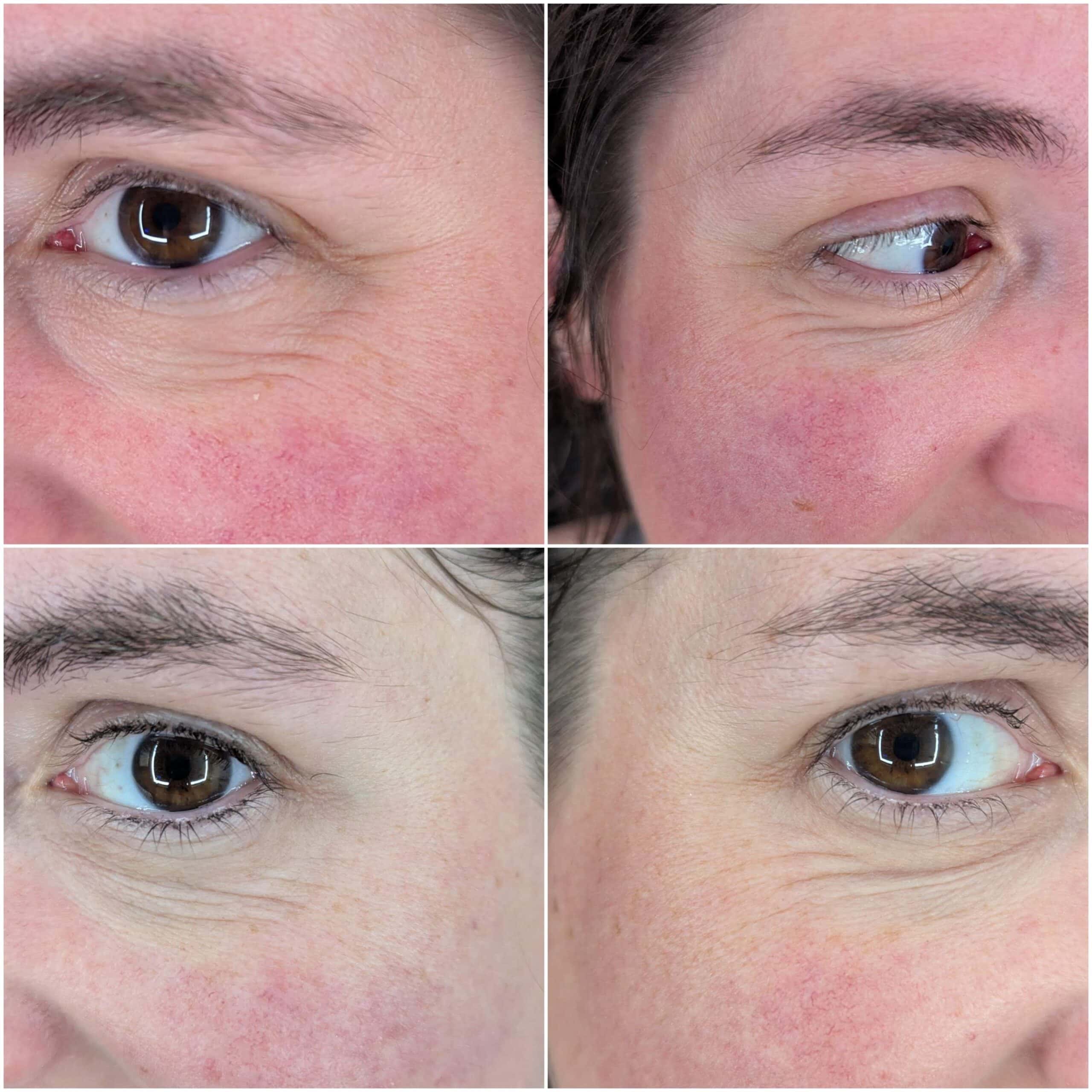 Before and after of skin, calmer and clearer