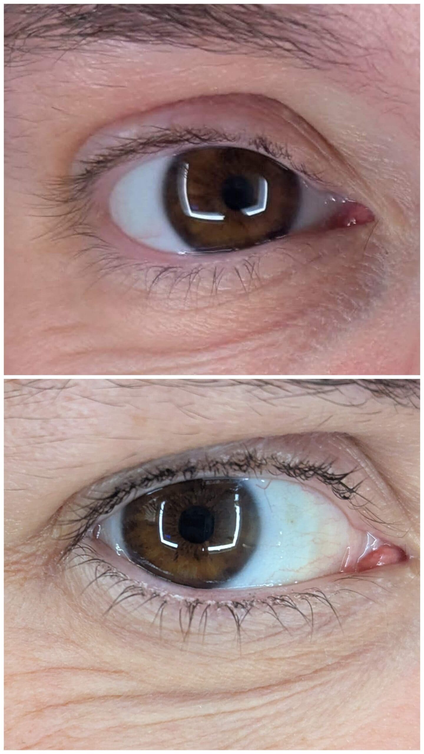 Before and after of eyelashes filling in